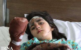جراحی پلاستیک روی 3 دانش آموز پیرانشهر انجام شد
 آغاز عمل های پیوند پوست در تبریز