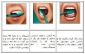 روش صحیح مسواک زدن و استفاده از نخ دندان-ویژه مربیان بهداشت